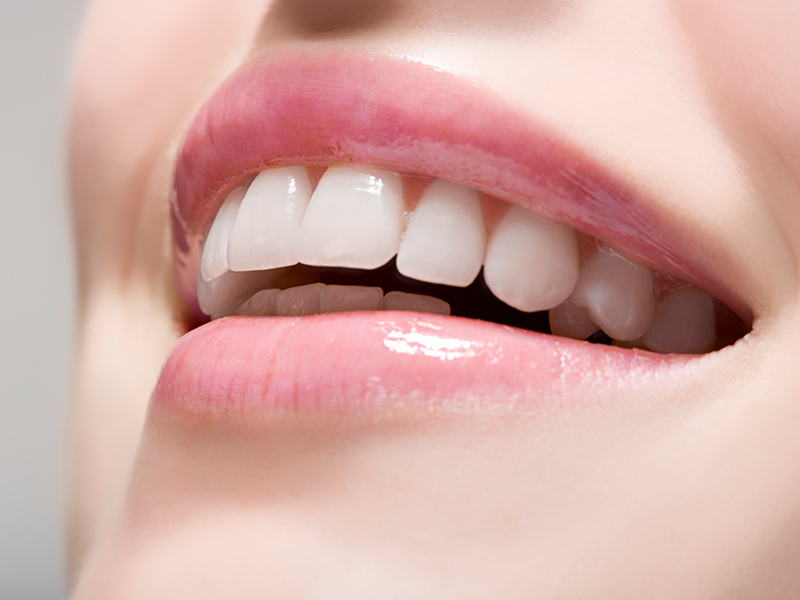 ホワイトニング